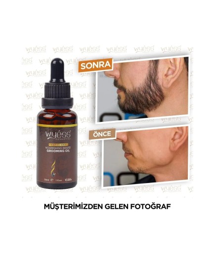 Sakal Bakım Yağı Serumu