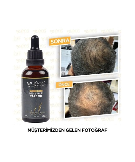 Erkek Saç Bakım Yağı Serumu