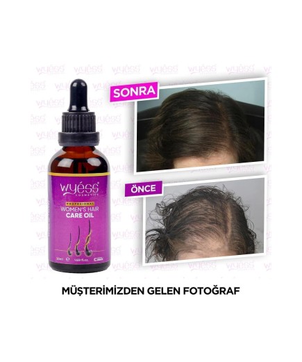 Kadın Saç Bakım Yağı Serumu